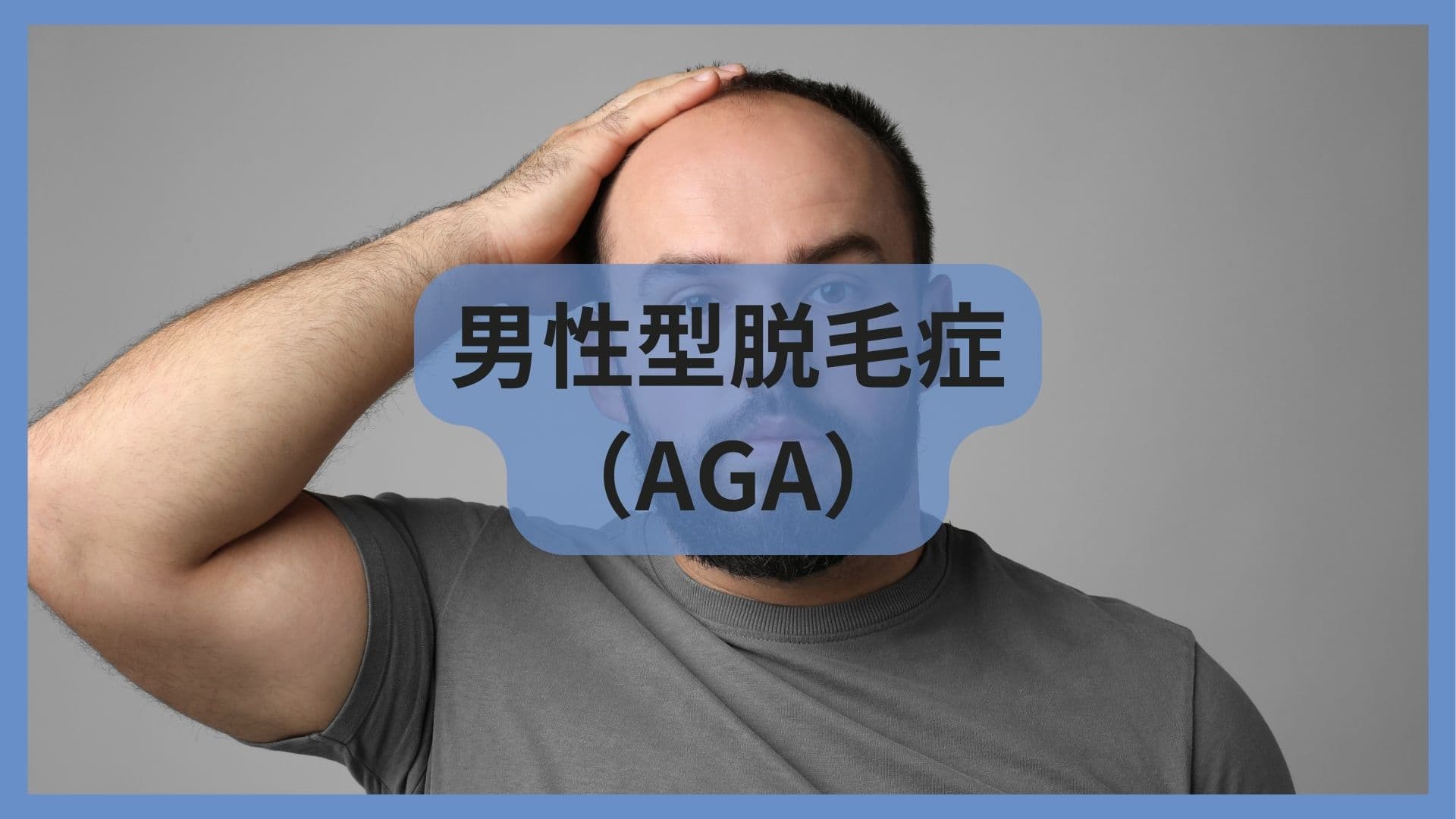 AGA(男性型脱毛症)完全ガイド——薄毛が気になり始めた30〜40代男性へ