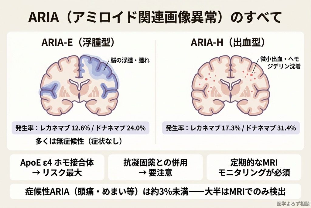 ARIAの分類（ARIA-EとARIA-H）、MRI所見、発生メカニズム、リスク因子を図解