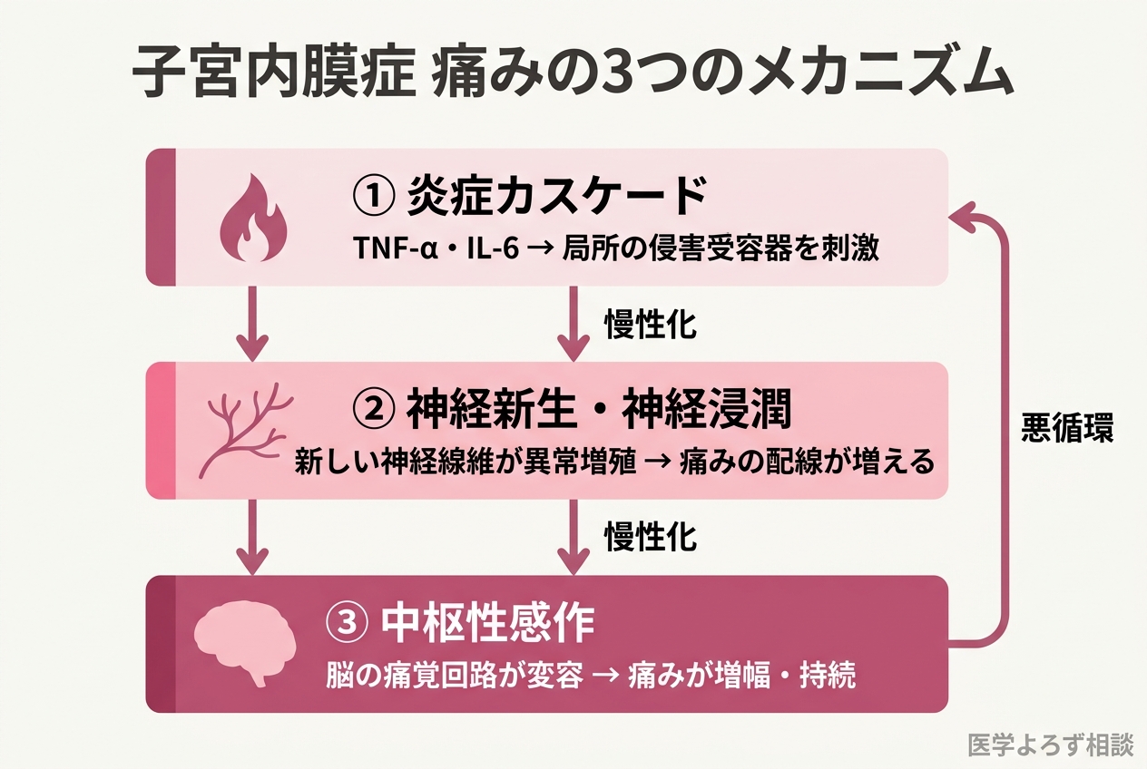 子宮内膜症の3層の痛みメカニズムを示す図。局所炎症、神経新生・浸潤、中枢性感作の3段階が相互に影響する