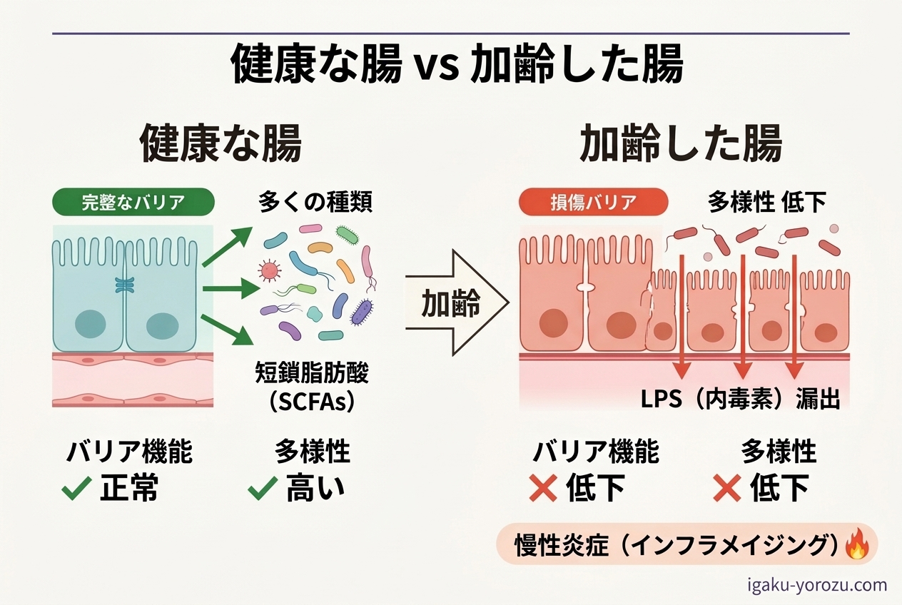 インフラメイジングのメカニズムを示す模式図。腸管バリア破綻、LPS漏出、全身性慢性炎症の連鎖を描く